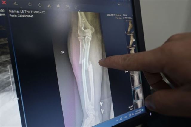 Người phụ nữ nhảy từ tầng 9 chung cư mini qua nguy kịch